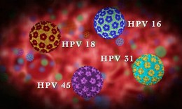 Mỹ mở rộng phạm vi sử dụng vắc xin ngừa ung thư v&#224; c&#225;c bệnh li&#234;n quan đến HPV