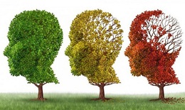 Thuốc ph&#243;ng xạ mới gi&#250;p chẩn đo&#225;n bệnh Alzheimer