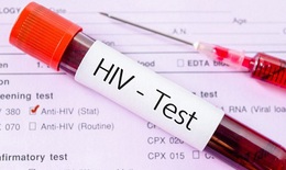 HIV c&#243; thể lan truyền từ n&#227;o bộ