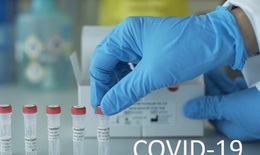 Phát triển thuốc kháng virus mới hy vọng có thể tiêu diệt SARS-CoV-2