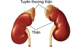 Thêm một liệu pháp điều trị cho bệnh nhi bị suy vỏ thượng thận