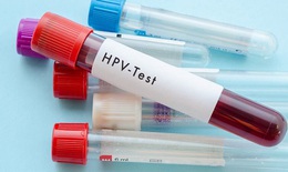 Khuyến nghị mới về xét nghiệm HPV để tầm soát ung thư cổ tử cung