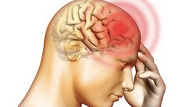 Chấn thương sọ não và Alzheimer gây suy giảm nhận thức tương tự nhau
