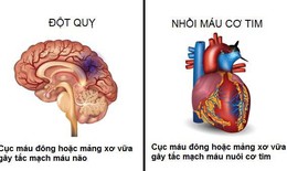 Tăng nguy cơ tim mạch ở người bệnh ung thư dùng liệu pháp nội tiết