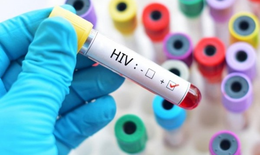 Nhiễm HIV làm tăng nguy cơ mắc COVID-19 nghiêm trọng: WHO cảnh báo
