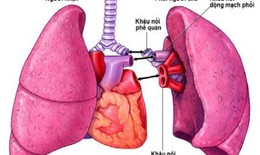 Thuốc chống đào thải dùng cho người bệnh ghép phổi