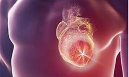 Tập thể dục giúp giảm tử vong ở người cấy ghép máy khử rung tim