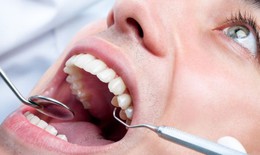 Anh cảnh báo gay gắt việc “tẩy trắng răng”