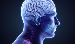 Điều gì xảy ra khi bị xuất huyết não