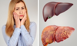 Thải độc ngay lập tức nếu bạn gặp phải 10 dấu hiệu này