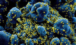 Vì sao cơn bão cytokine có thể gây tử vong ở bệnh nhân COVID-19?