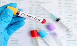 Chẩn đoán thiếu sắt và quá tải sắt qua nồng độ ferritin huyết thanh