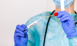 Tìm ra phương pháp test nhanh định lượng kháng thể chống lại SARS-CoV-2