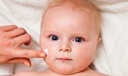 Xử trí và phòng ngừa tái phát bệnh chàm