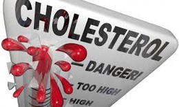Các yếu tố nguy cơ làm tăng cholesterol