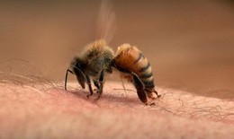 Người đàn ông bị loạn thần, suy gan, suy thận vì ong đốt