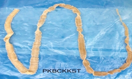 Nhiễm sán dây dài hơn 1m có màu vàng nâu vì thói quen ăn thịt tái