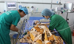 Bé gái ngã từ trên cao, bị cành cây chọc thủng từ hậu môn tới ruột