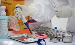 Khẩn: Bổ sung thực hiện cách ly tại nhà và lấy mẫu xét nghiệm sàng lọc COVID-19 ở Yên Bái