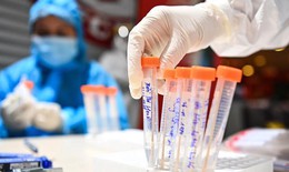 Cà Mau: 308 m&#226;̃u sàng lọc cho c&#244;ng nh&#226;n đ&#234;̀u &#226;m tính