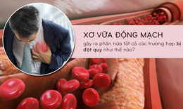 Đột quỵ từ xơ vữa mạch, vì đâu nên nỗi?