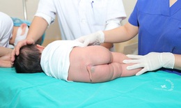 "Cắt đuôi" cho bé 5 tháng tuổi
