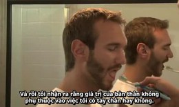 Tự sự vươn lên đầy cảm động của Nick Vujicic