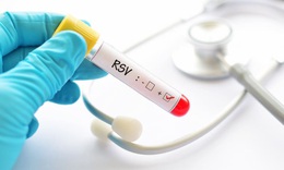 Virus RSV - &#39;Kẻ th&#249;&#39; g&#226;y bệnh h&#244; hấp ở trẻ nhỏ