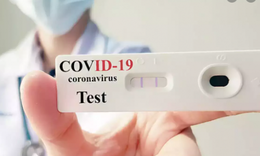 Bộ Y tế đang x&#226;y dựng Th&#244;ng tư hướng dẫn gi&#225; dịch vụ x&#233;t nghiệm ph&#225;t hiện virus SARS-CoV-2
