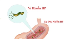 Diệt vi khuẩn H.P ph&#242;ng ung thư dạ d&#224;y cần thiết hay kh&#244;ng?