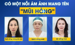 N&#226;ng mũi qu&#225; cao v&#224; những rủi ro tiềm ẩn