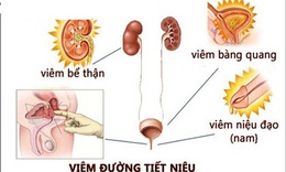 Vi&#234;m đường tiết niệu do vi khuẩn, triệu chứng v&#224; c&#225;c thuốc điều trị