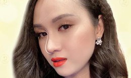 Sụn nâng mũi nên lựa chọn loại nào?