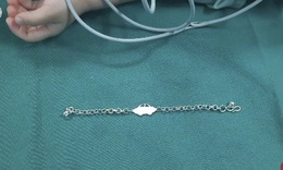 Cháu bé 2 tuổi nuốt trọn chiếc dây chuyền đeo chân
