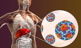 Bạn c&#243; nguy cơ mắc virus vi&#234;m gan từ những th&#243;i quen  tưởng v&#244; hại n&#224;y