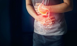 Nếu có những dấu hiệu này, coi chừng xuất huyết dạ dày nguy hiểm tính mạng