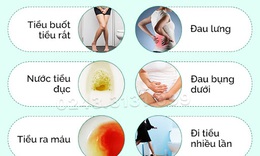 Thảo dược chữa vi&#234;m đường tiết niệu cấp t&#237;nh