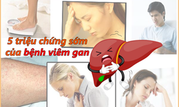 5 triệu chứng sớm của viêm gan và gợi ý hỗ trợ gan phục hồi