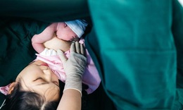 Da kề da sau sinh: Lợi ích không ngờ từ “cái ôm đầu tiên của mẹ”