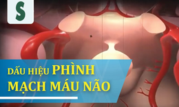 T&#250;i ph&#236;nh động mạch n&#227;o - &quot;Quả bom&quot; chờ nổ