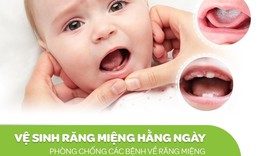 Gạc răng miệng tẩm ẩm đ&#250;ng ti&#234;u chuẩn cho trẻ nhỏ