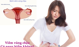 Bệnh vi&#234;m v&#249;ng chậu điều trị như thế n&#224;o?