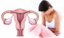 Tử cung bất thường c&#243; thể g&#226;y hiếm muộn?