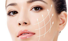 Căng chỉ collagen c&#243; hiệu quả vĩnh viễn kh&#244;ng?