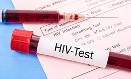 Kh&#225;nh H&#242;a: Linh hoạt c&#225;c giải ph&#225;p, m&#244; h&#236;nh ph&#242;ng, chống HIV/AIDS