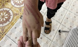Diễn biến mới nhất vụ bé trai 8 tuổi bị bạo hành ở Hải Phòng