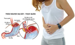 Th&#244;ng tin mới trong điều trị tr&#224;o ngược dạ d&#224;y thực quản