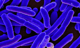 Vi khuẩn E.Coli kh&#244;ng &#39;l&#224;nh&#39; như bạn vẫn nghĩ v&#224; 5 ch&#236;a kh&#243;a ph&#242;ng ngộ độc thực phẩm