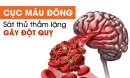 4 loại gia vị hỗ trợ giảm nguy cơ hình thành cục máu đông