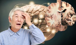 C&#225;ch ngăn ngừa bệnh Alzheimer tiến triển